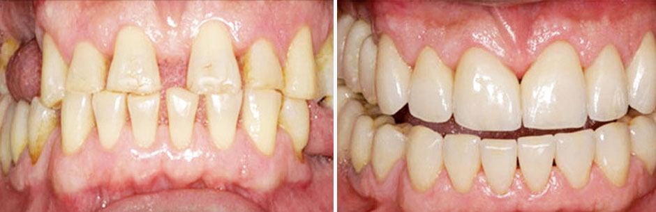 reabilitacao-oral-com-ortodontia